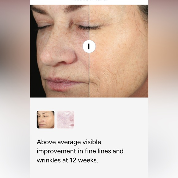 Hydrinity Retaxone Daily Retinal Hydrator powerful results even sensitive skin - Picture 4 of 9